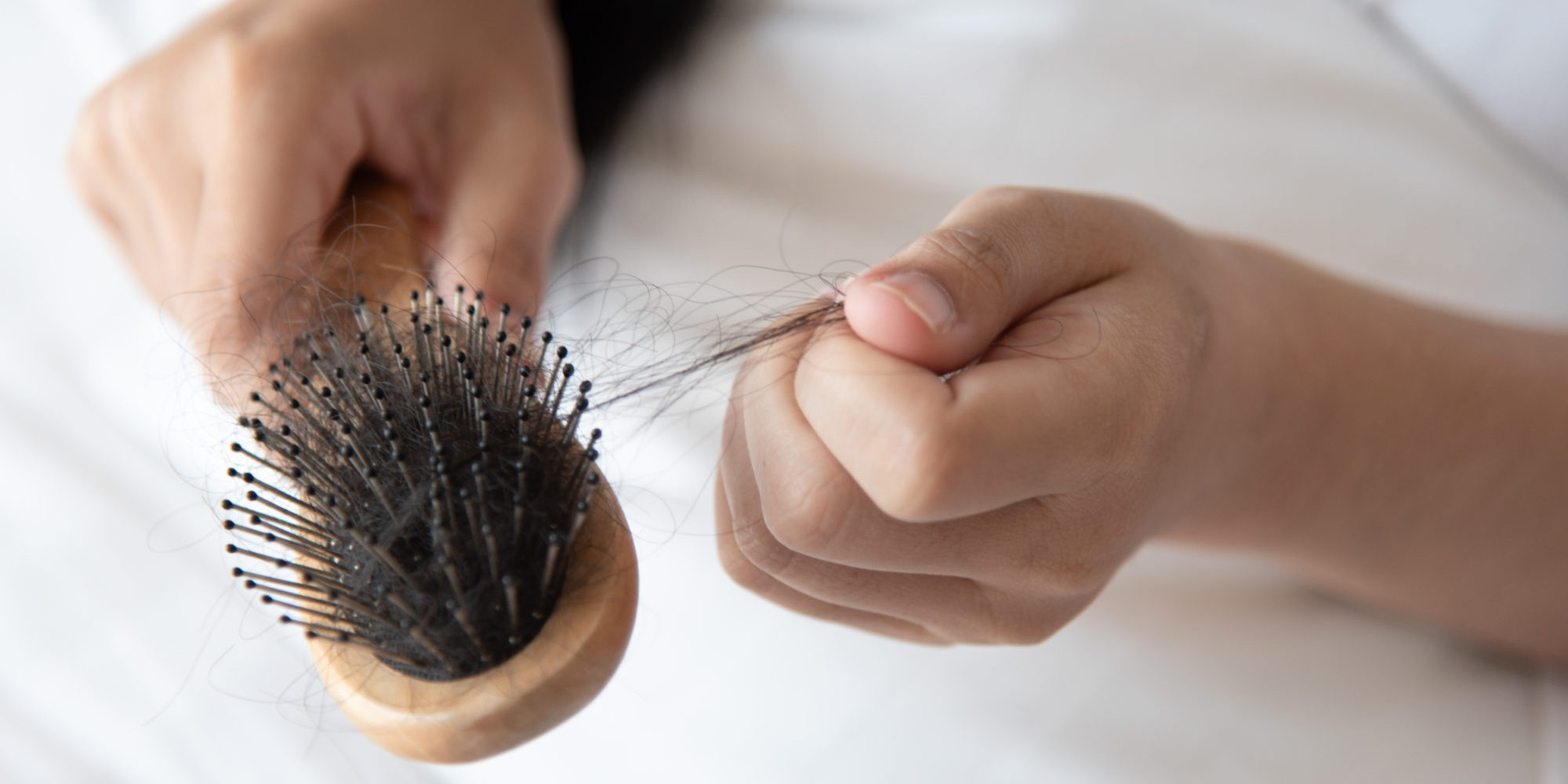 Queda de cabelo pós cirurgia bariátrica Queda de cabelo pós cirurgia bariátrica