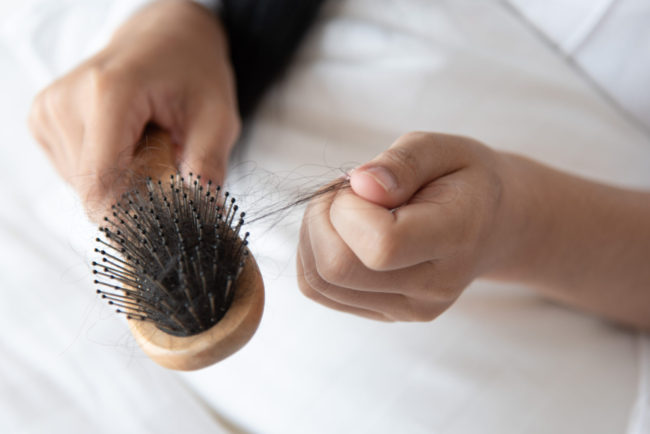 Queda de cabelo pós cirurgia bariátrica Queda de cabelo pós cirurgia bariátrica