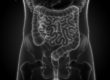 Cirurgia bariátrica e alteração do microbioma intestinal